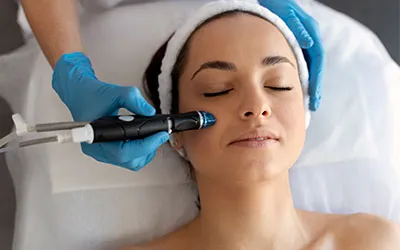 Microneedling Therapy Treatment in New Gota