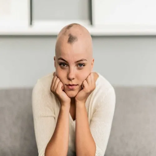 Hair Growth in Cancer Patient